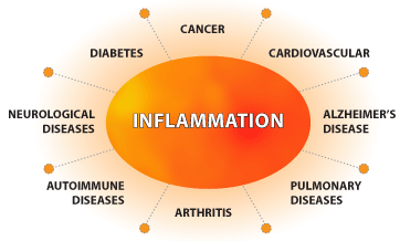 Five Easy Ways To Reduce Inflammation
